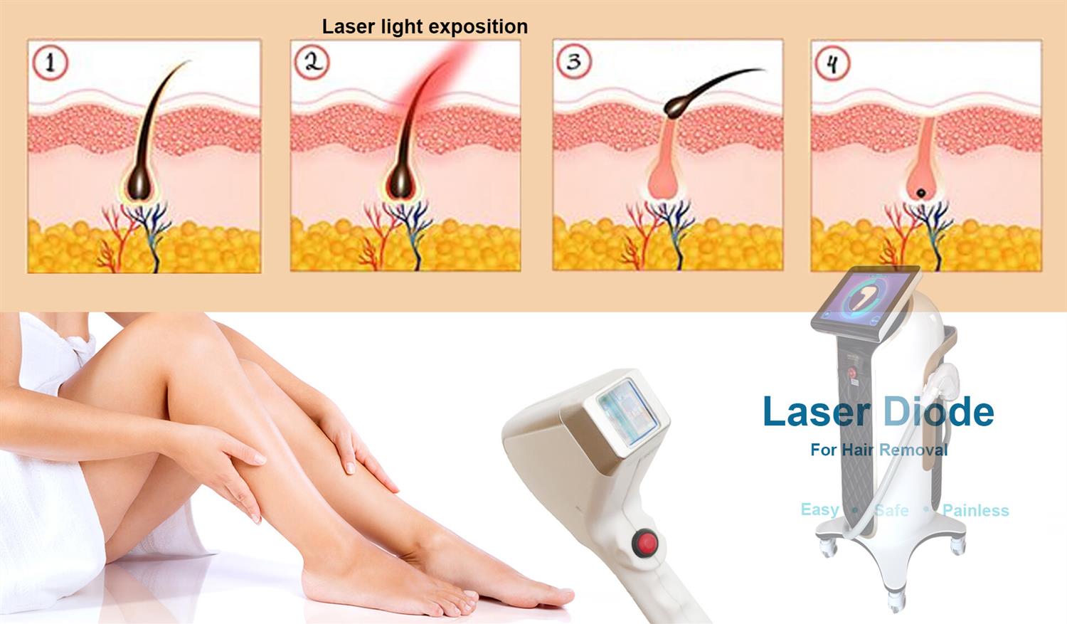 Triệt Lông Mép - Cằm 